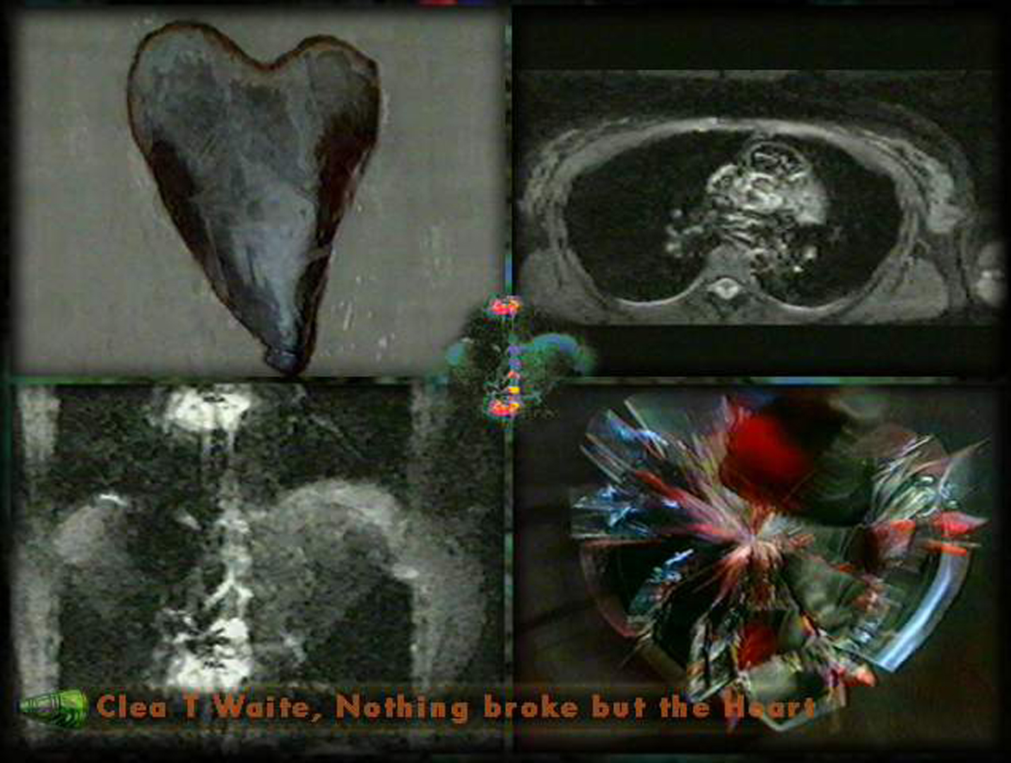 ©, , Nothing Broke but the Heart